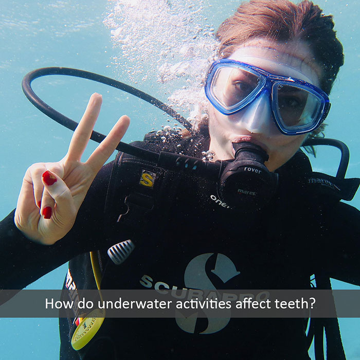 underwater teeth 2022 700
