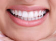 cosmetic dentistry cosmetic dentist near me San Diego dentist