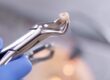 tooth extraction